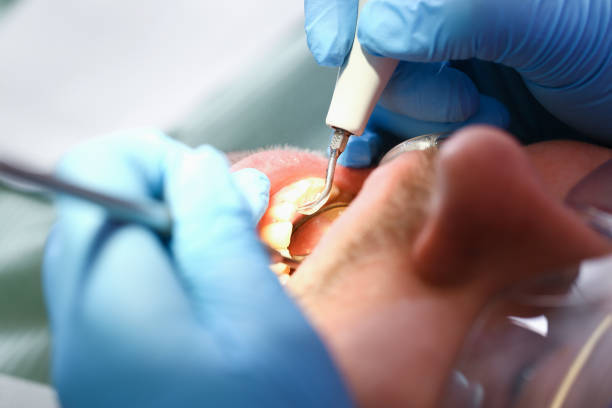 Best Emergency Treatment for Toothache in Olney, IL