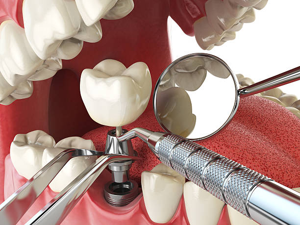 Best Emergency Dental Surgery in Olney, IL